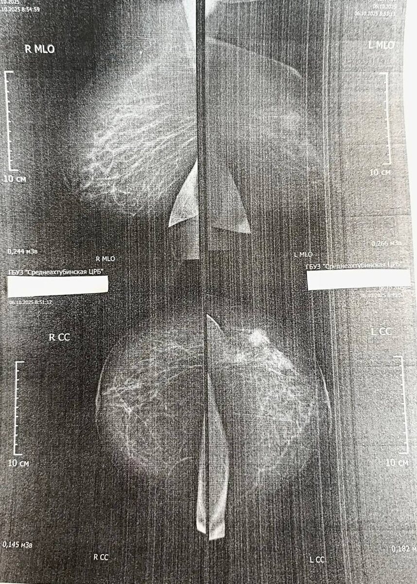 маммография пациентки