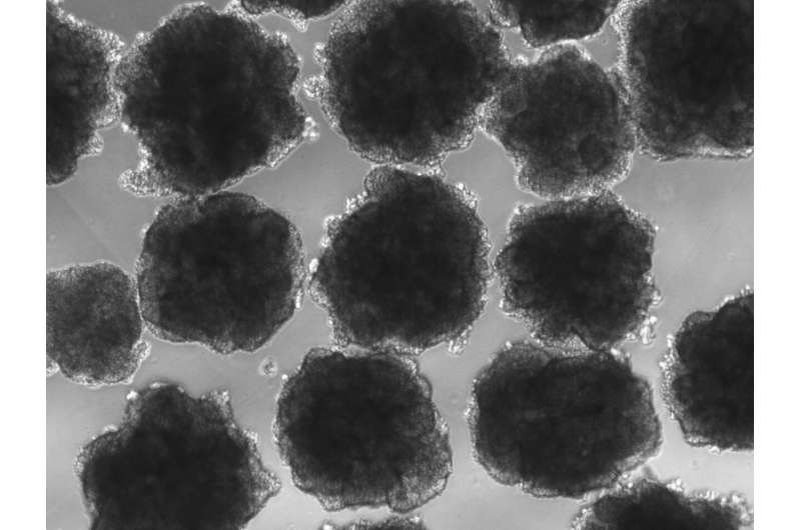 Используя органоиды человеческого мозга (миниатюрные лабораторные модели мозга), группа сравнила воздействие свинца на две версии ключевого гена развития NOVA1, который, как известно, регулирует экспрессию генов при воздействии свинца в процессе нейроразвития. Современная человеческая версия NOVA1 отличается от той, что обнаружена у неандертальцев и других вымерших гоминидов. Источник: Калифорнийский университет в Сан-Диего.
