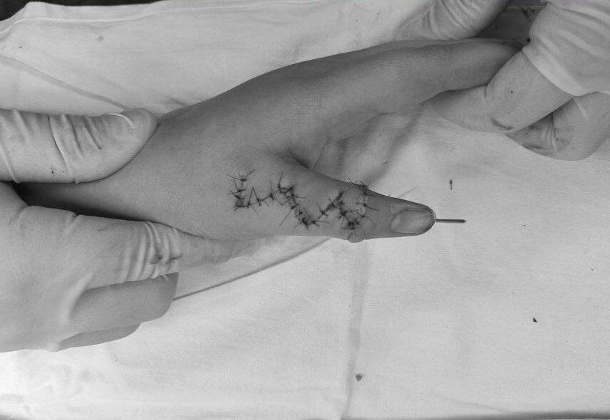     / Источник: t. me/operativnyishtabtyumen