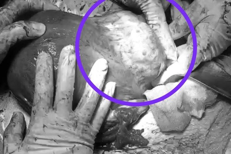    Фото: РКБ Татарстана / Telegram