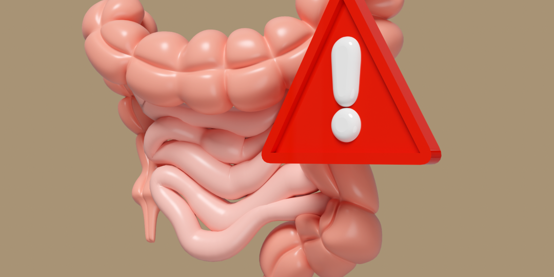 Синдром раздражённого кишечника: как понять свой кишечник и помочь ему работать правильно?