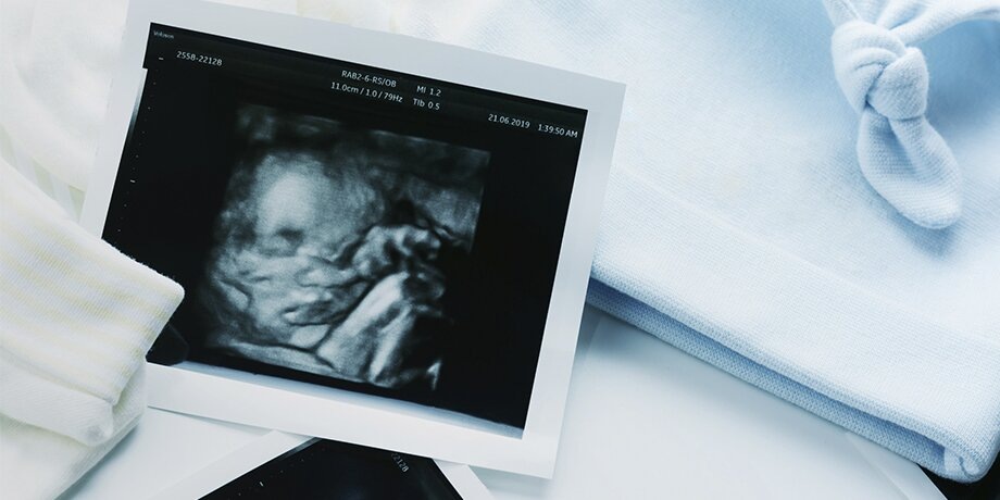    Фото: 123RF.com/kriangfhoto31