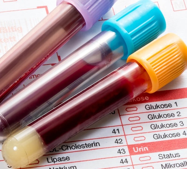 Как часто нужно сдавать анализы?