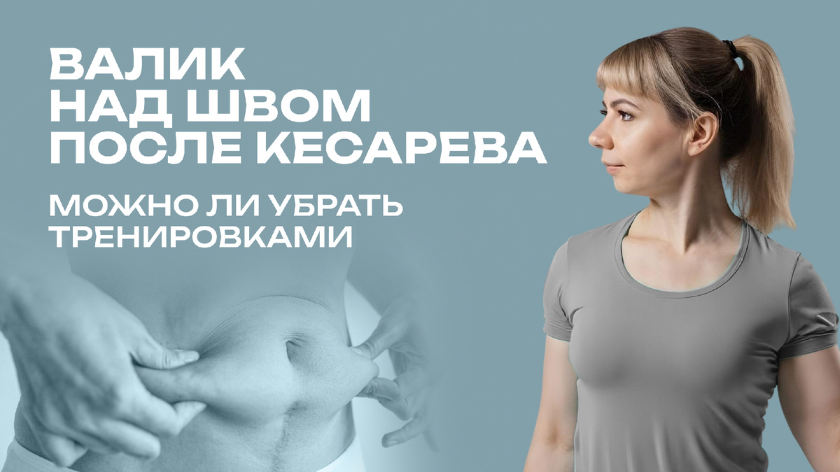 Как убрать валик над швом после кесарева сечения?