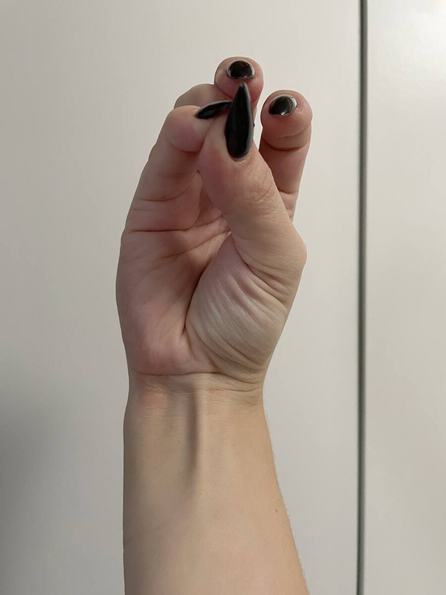 У меня, как видите, есть. На обеих руках