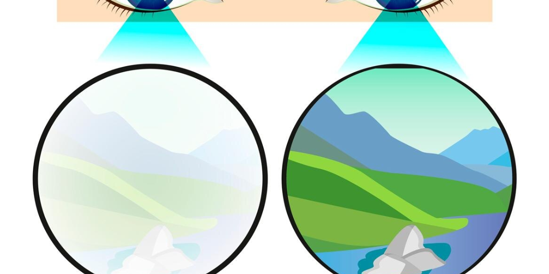 Почему один глаз может видеть хуже другого?