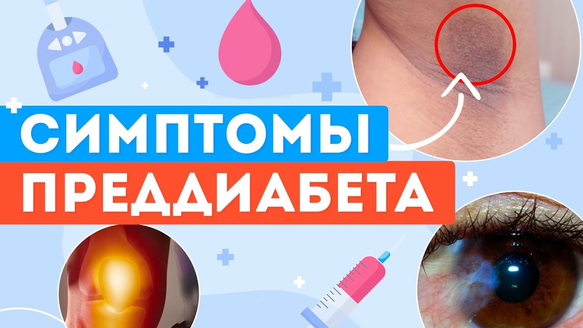 Скрытые признаки начинающегося диабета: на которые не обращают внимания