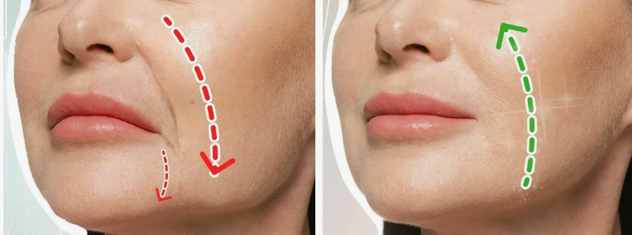 Без крема вернуть молодость: никаких носогубных складок и брылей на лице - 3 обязательные зоны для массажа