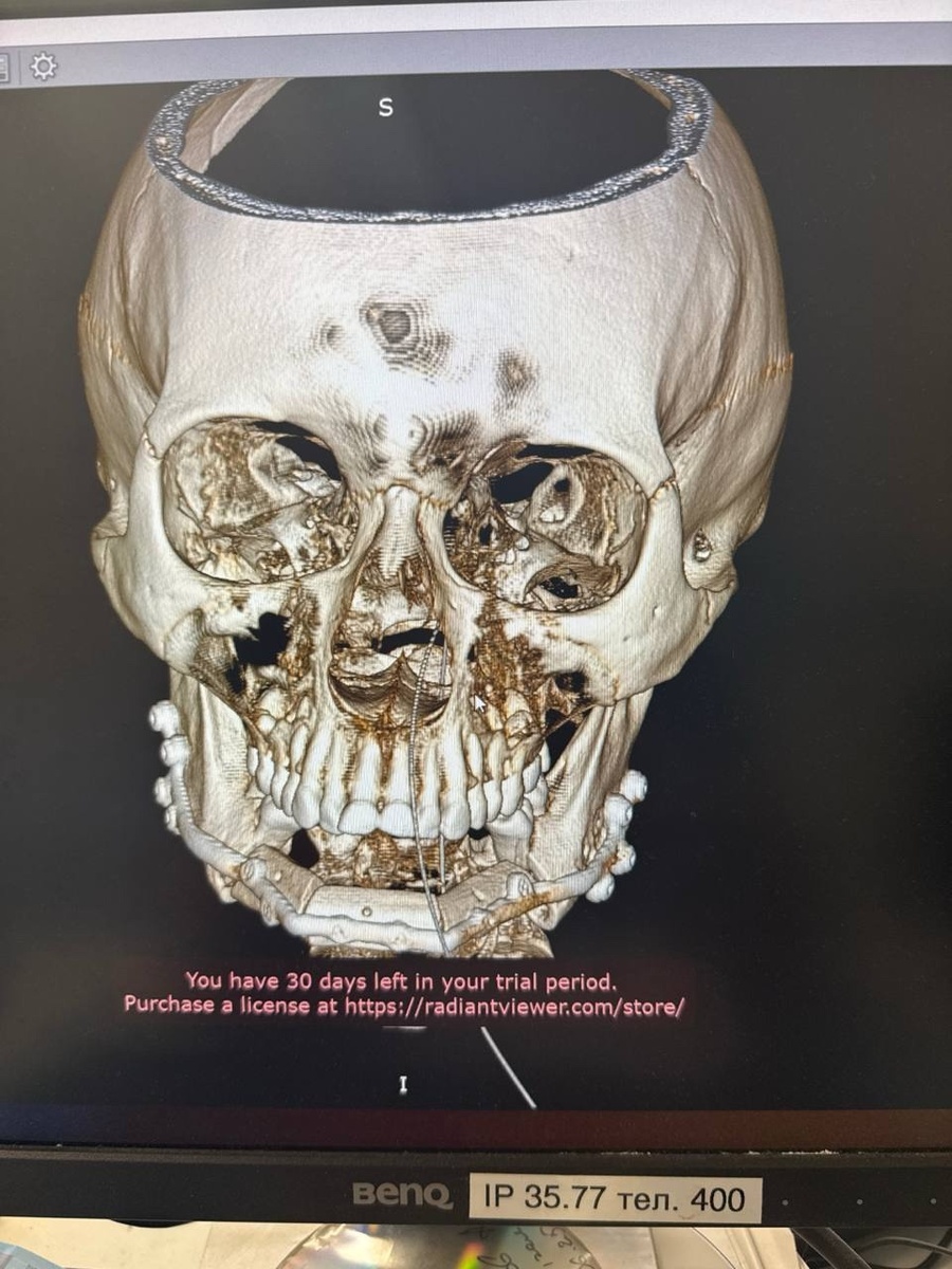    Фото: Краевая клиническая больница