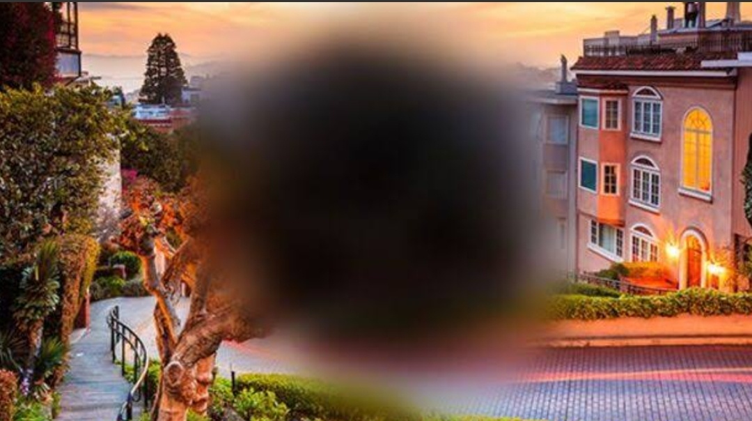 Макулодистрофия