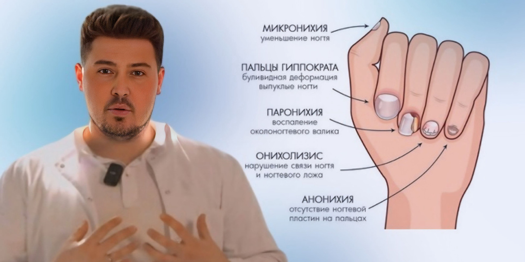 Что расскажут ваши ногти о здоровье: 15 тревожных сигналов от тела, которые нельзя игнорировать