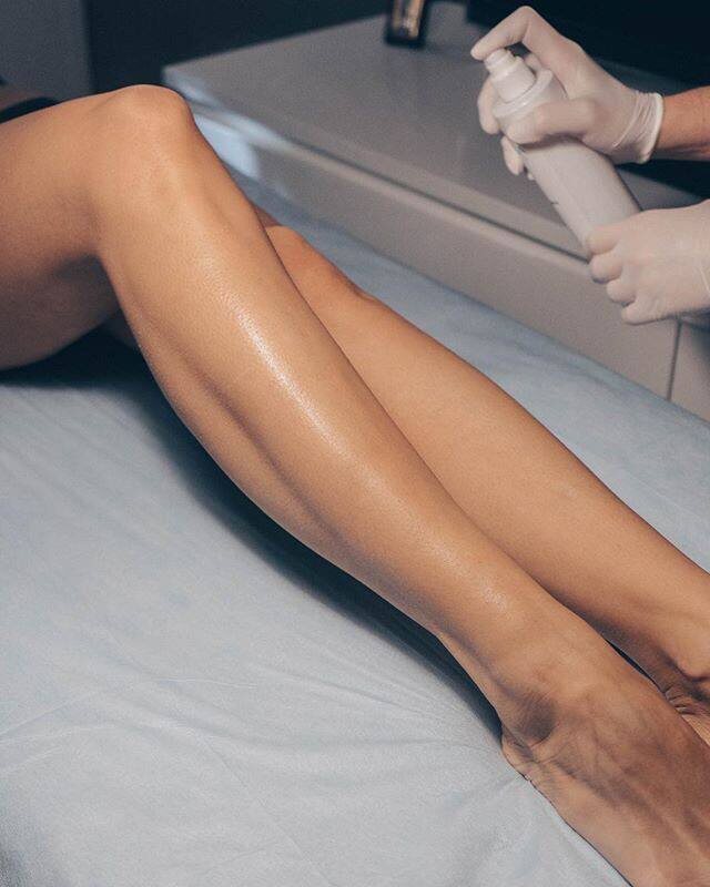 Эпиляция для женщин
