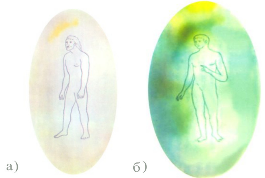а) каузальное тело неразвитого человека, б) каузальное тело обычного человека (по Ч. Ледбитеру, «Человек видимый и невидимый»)