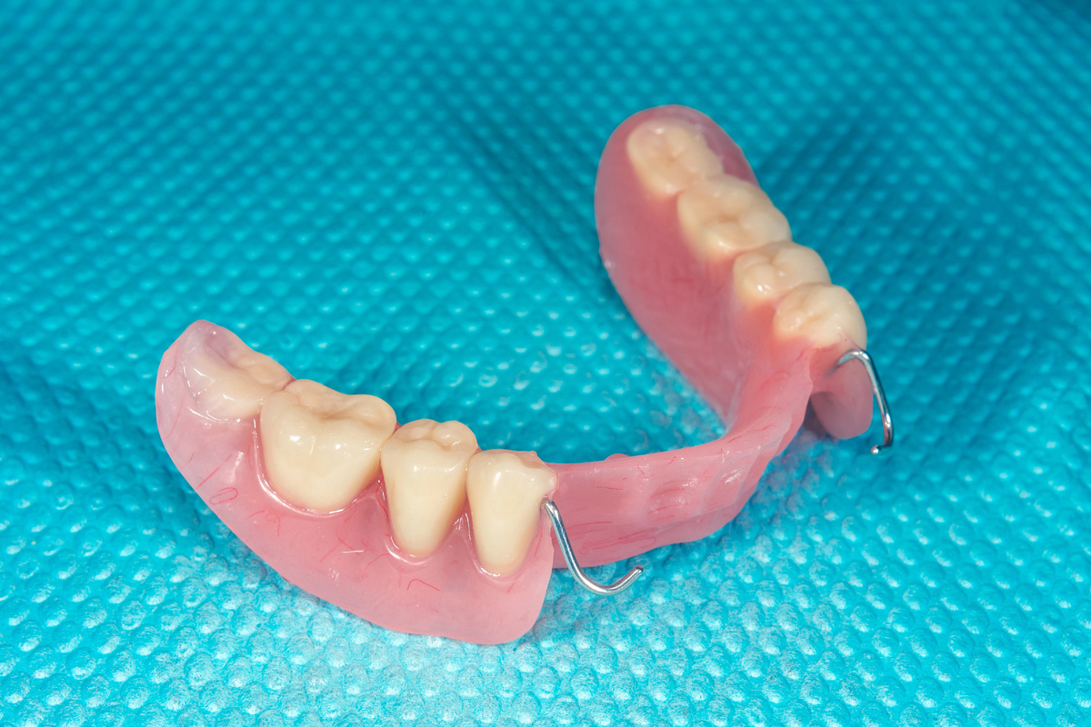 Съемный акриловый протез