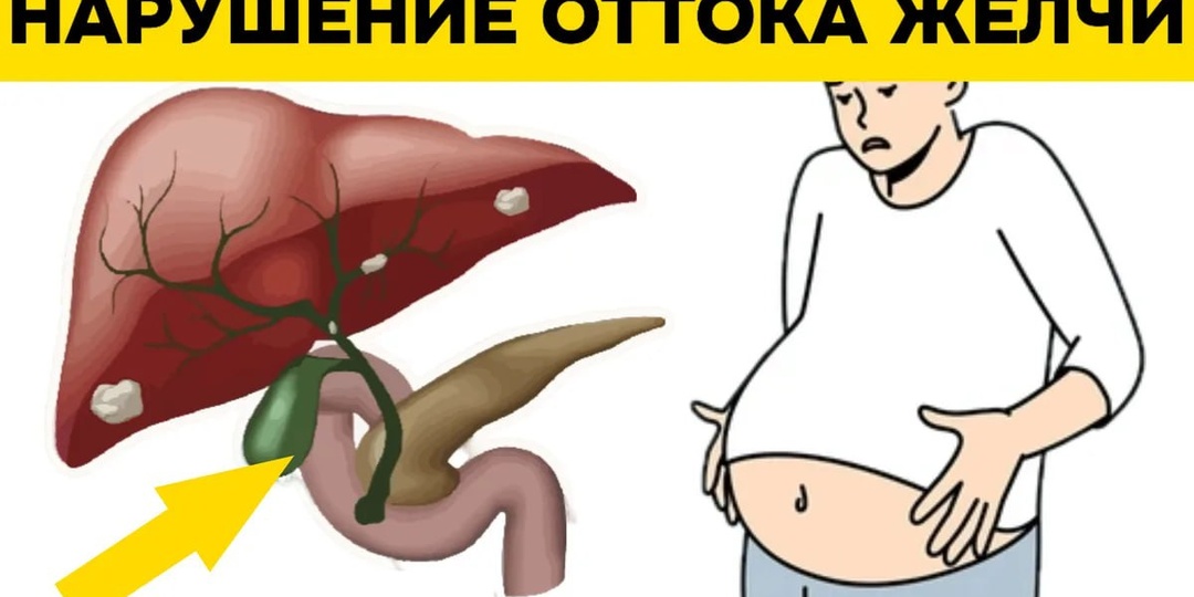Почему «застаивается» желчь и как это ощущается в теле