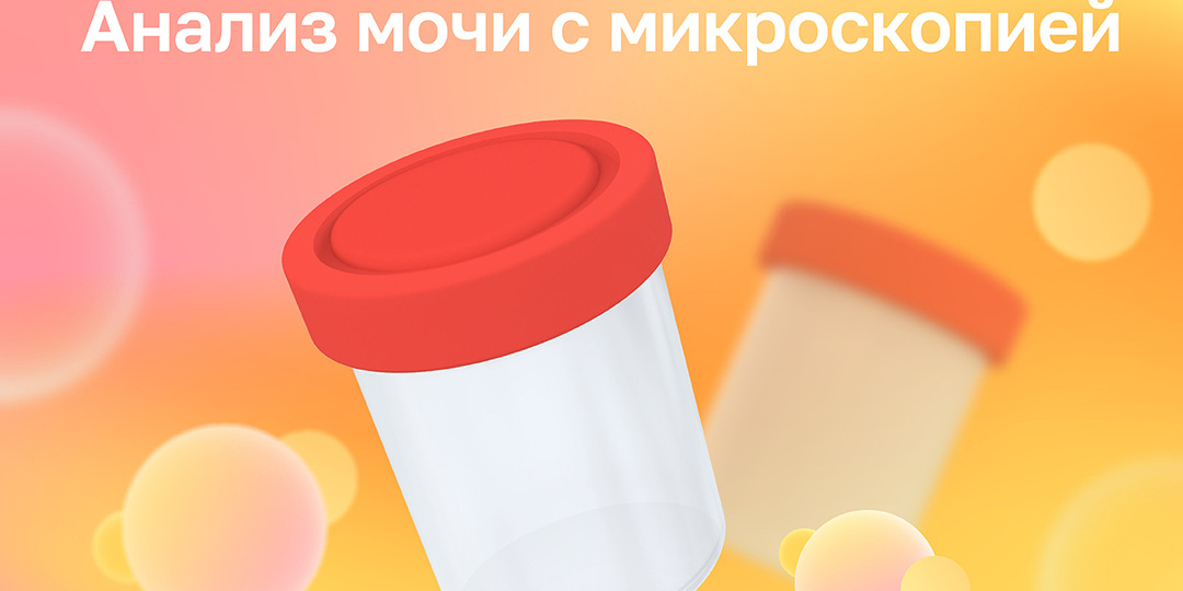Анализ мочи с микроскопией: когда важна каждая деталь