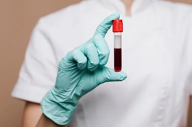    К чему снится кровь?