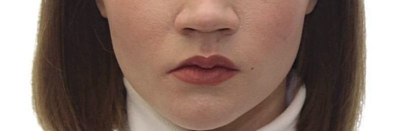 Когда-нибудь и про этот случай молодой девушки я напишу статью