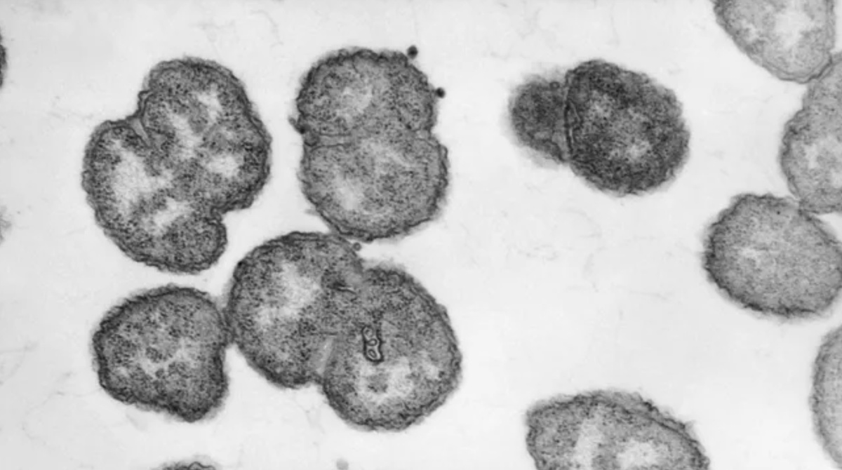    Бактерии Neisseria gonorrhoeae под микроскопом. Источник изображения: Live Science