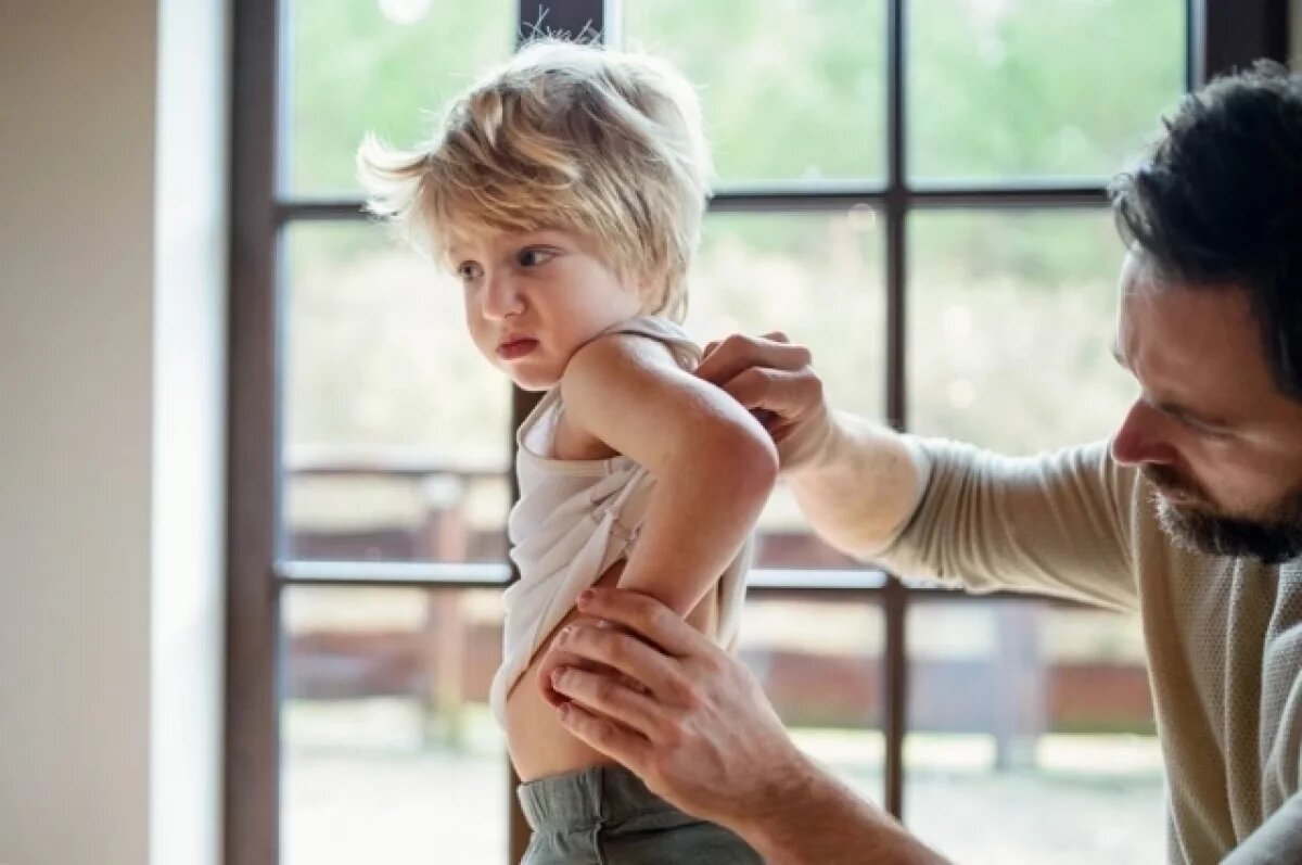    Роспотребнадзор в Приморье зафиксировал снижение заболеваемости лишаем