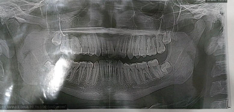 Даже неспециалисту видно, что верхний ряд уехал в сторону