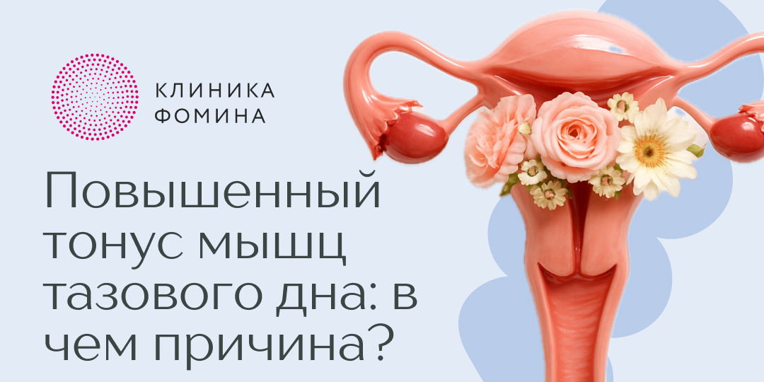 Скрытые последствия повышенного тонуса мышц тазового дна