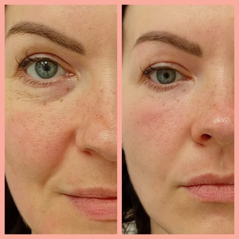 Моя работа на клиенте