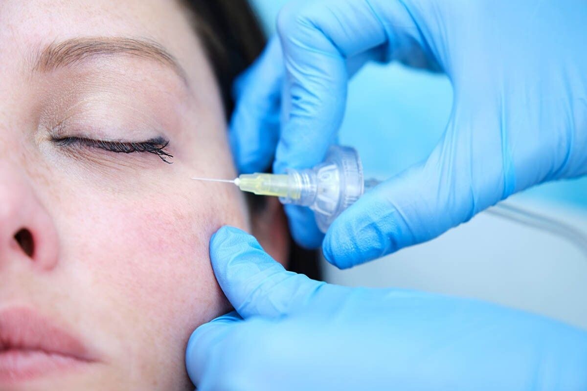 Косметолог поможет комплексно поработать над проблемой и уменьшить видимость мешков. Источник: AlvaroMP / Shutterstock / FOTODOM📷
