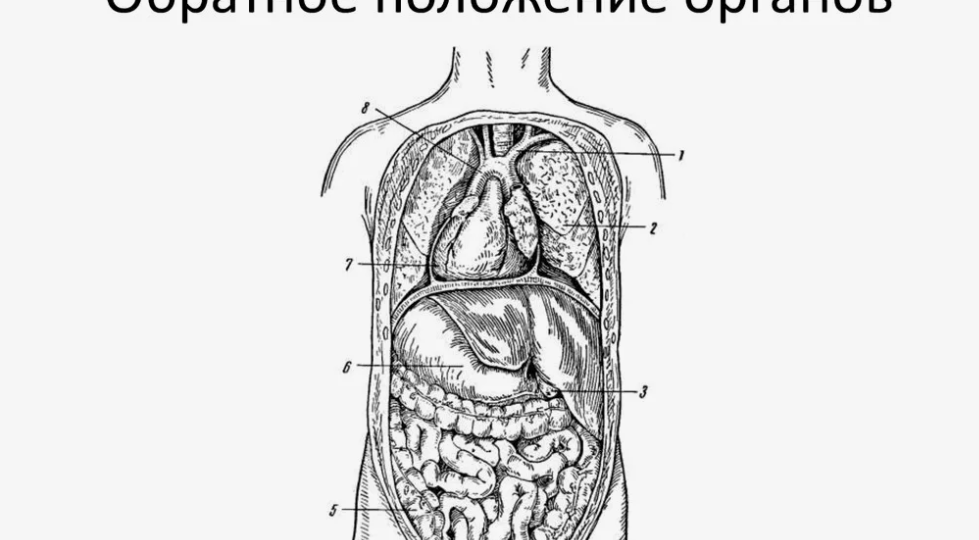 Органы наоборот: что такое транспозиция органов?