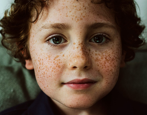 Здоровая кожа - это роскошь. Но начинаешь то понимать, когда возникают проблемы. Особенно когда проблемы возникают у ребенка. Изображение by supa.ru