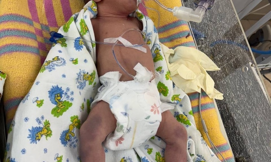 «Акушеры годами безнаказанно делают наших детей инвалидами»: запрещённый приём Крителлера при родах - новая жертва