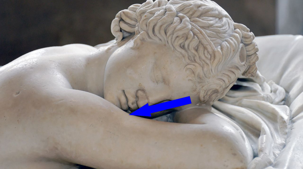    ПЯТЬ СОННЫХ ПРОФИЛЕЙ МОГУТ ВЫЯВИТЬ МЕНТАЛЬНЫЕ РАССТРОЙСТВА