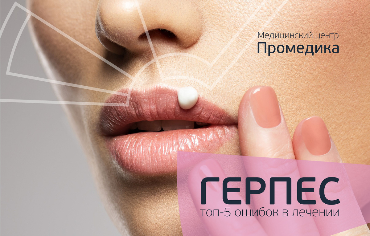 Герпес: 5 главных ошибок в лечении