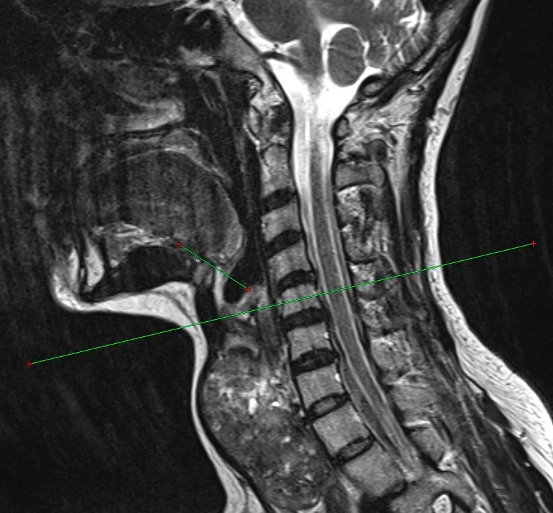     Оренбургские медики разработали безопасный метод перевязки щитовидной железы Оренбуржье
