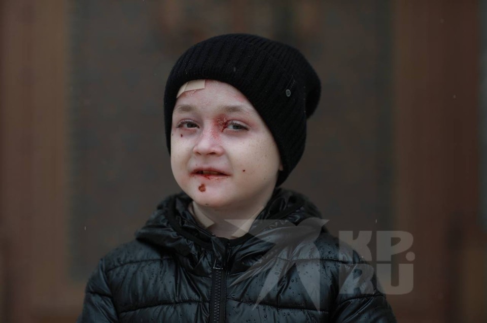 Мальчик родился без кожи на ноге. Фото: Анна ПЕШКОВА