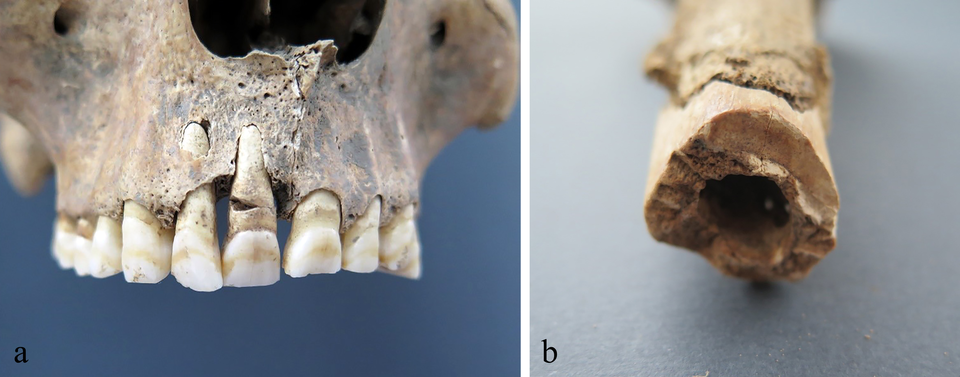   Mario Novak et al. / PLoS ONE, 2025