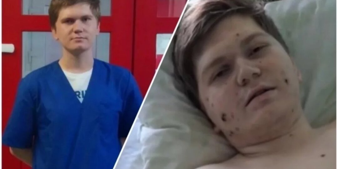 «Спасите моего сына!» Студент-медик с острым лейкозом оказался на грани жизни и смерти, и семья молит о спасении