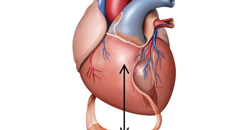 Тревожит сердце? Ищите причину в желудке. Клинический случай.