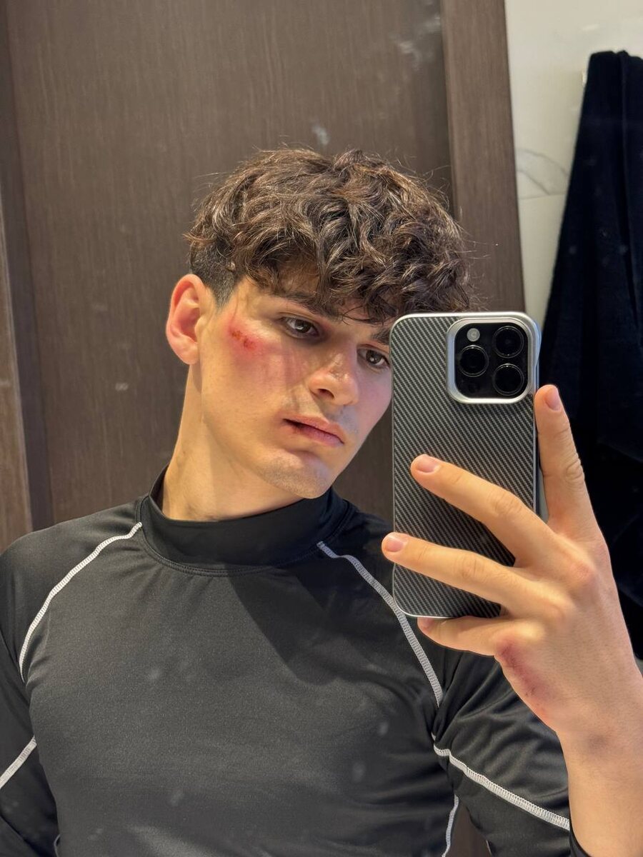 Фото: телеграм канал Мусима Ашурова 