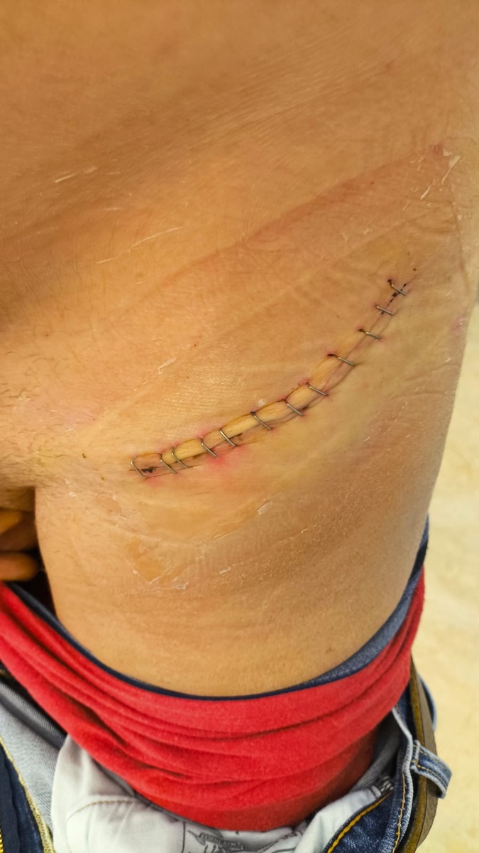 12 сантиметров