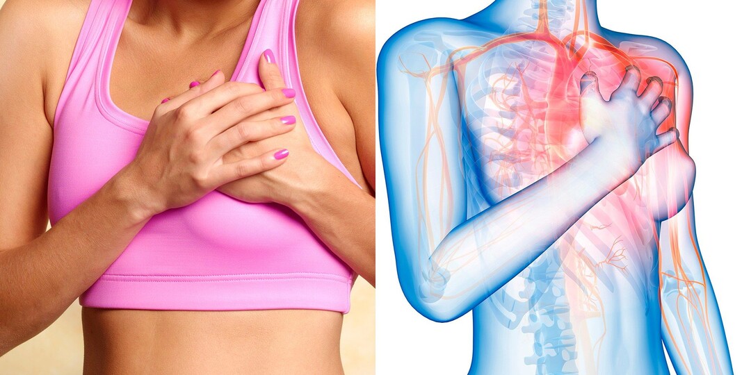 Как понять, что это не сердце, а защемление нерва (интервью)