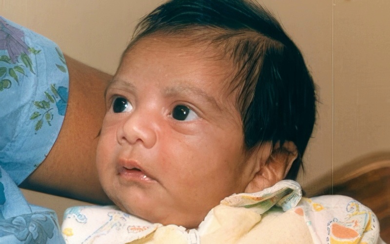 26 октября — пересадка ребенку сердца павиана