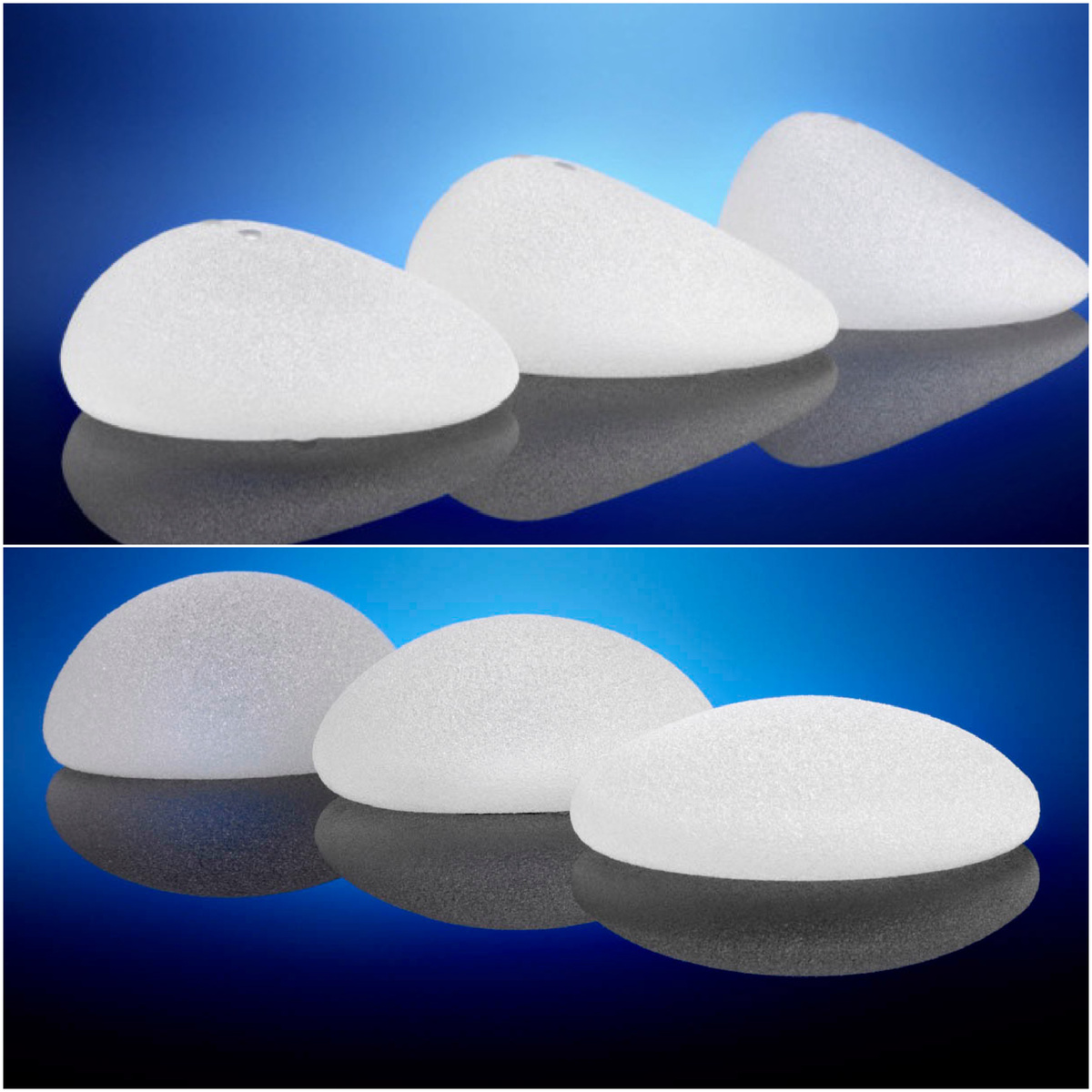 Круглые и анатомические импланты