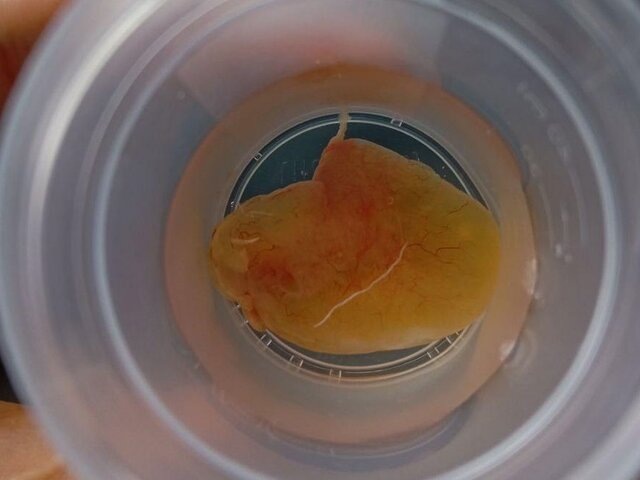    Фото: министерство здравоохранения Московской области/