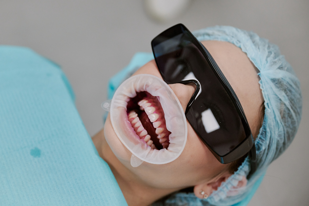  OptraGate при профессиональной гигиене. 
