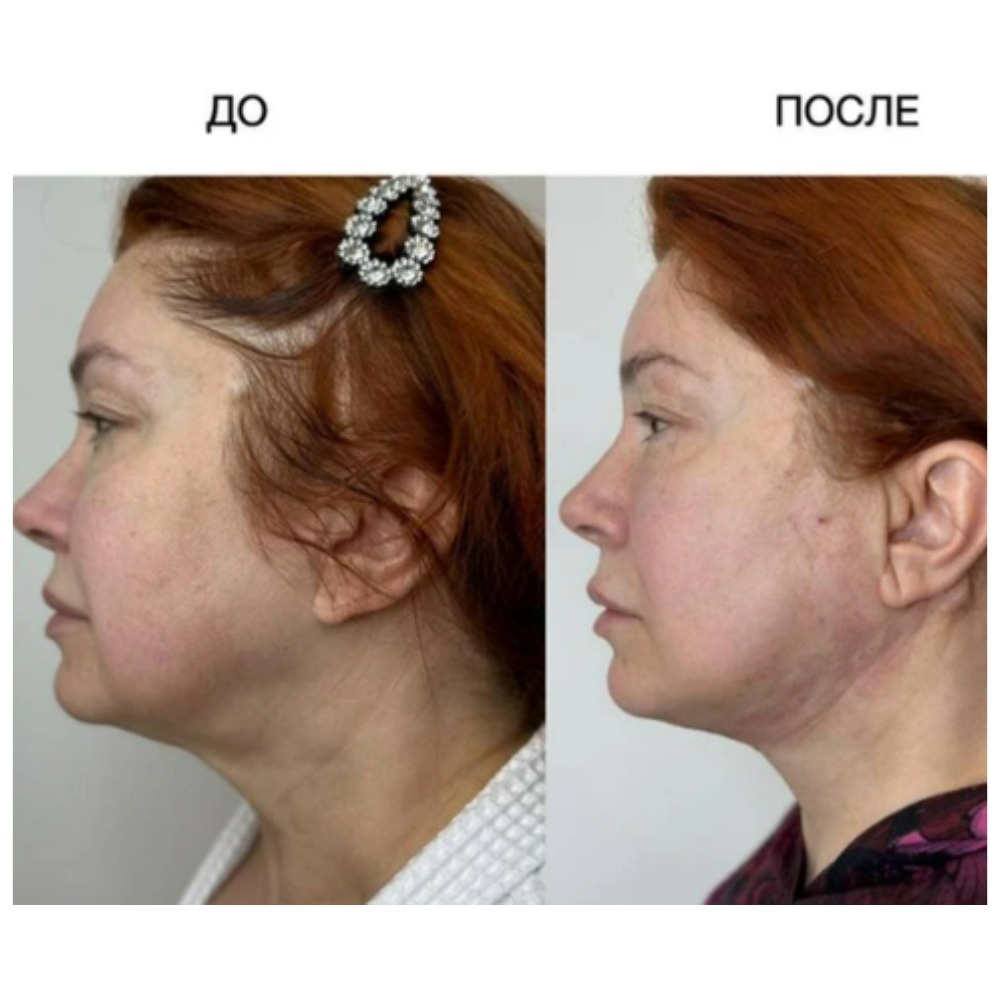 Я вижу эффект, а вы?