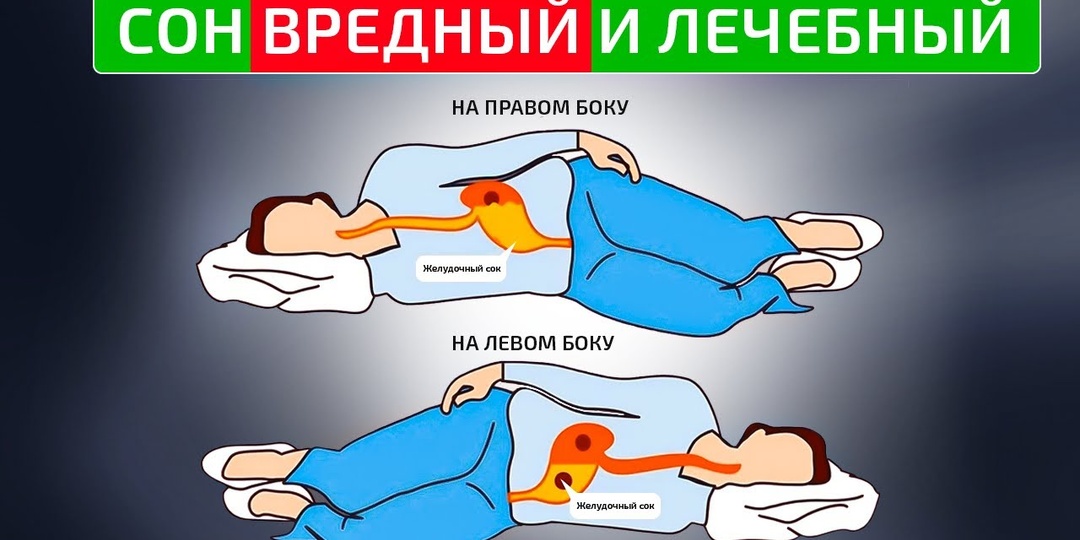 Почему Не Стоит Спать на Левом Боку После 55