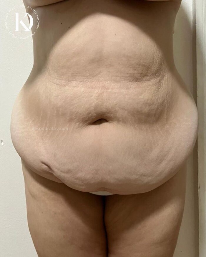 фото для онлайн консультации