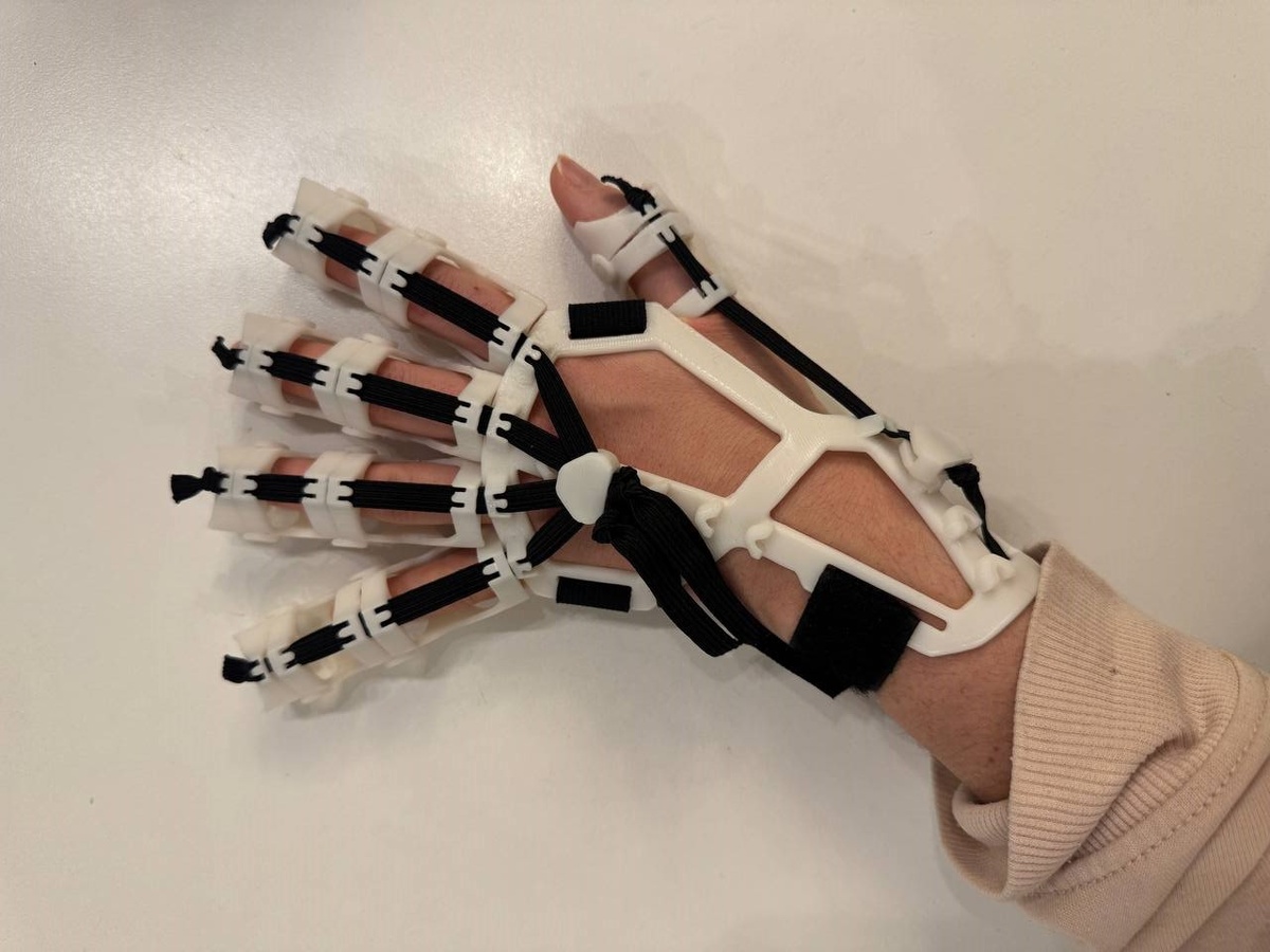 Ортез напечатанный на 3D-принтере