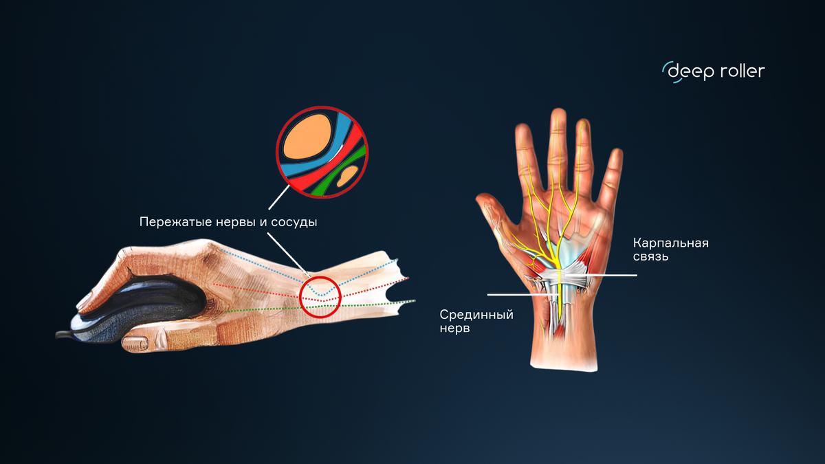 Строение кисти
